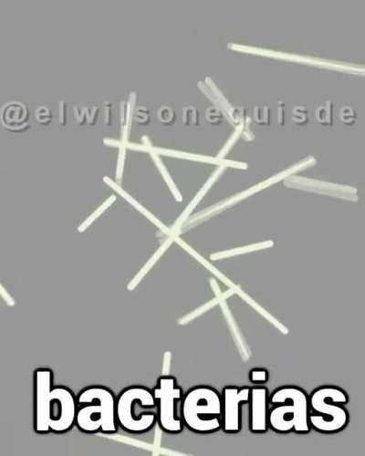 XDDDDDDDDDD