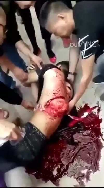 Machete attack