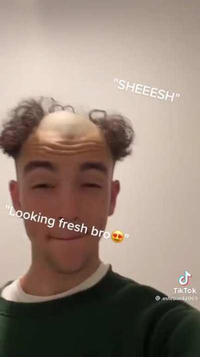 Bro got the drip