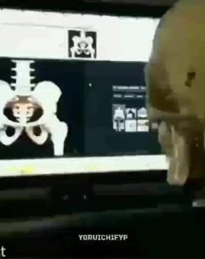 BONE hub