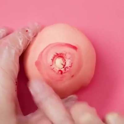 Pimple Popper's Revenge
