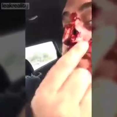 Шлем не всегда спаса<wbr>ет...