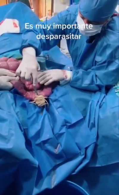 Are those WORMS???