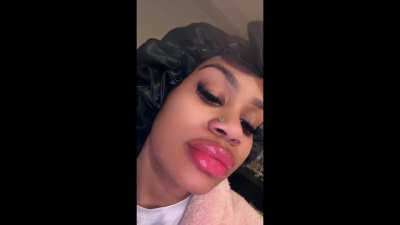 rate dem lips