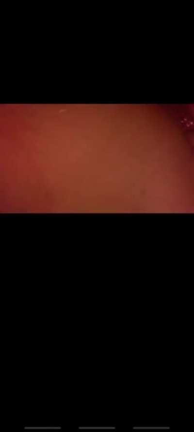 🔥