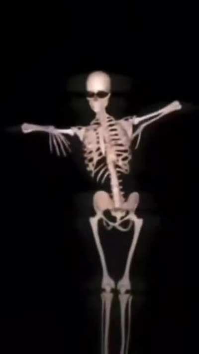 blursed_hotskeleton