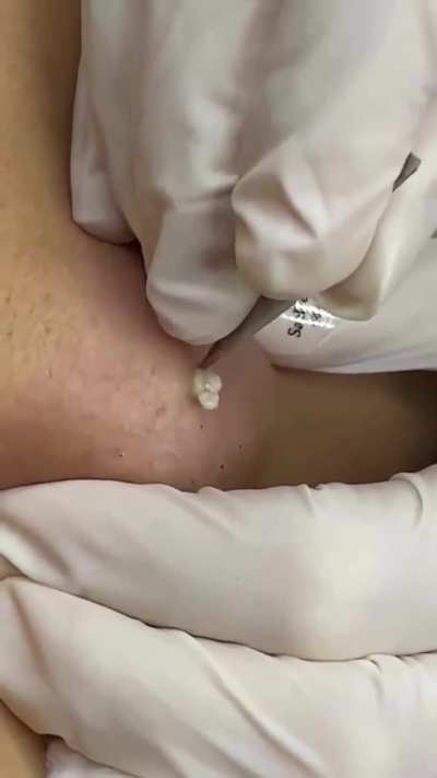 What is this?