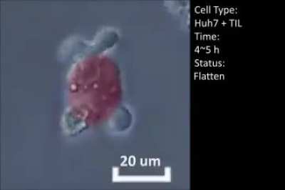 Real time video of tumor infiltrating lymphocytes attacking cancer cell.