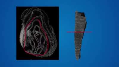 Virtually unwrapping and producing a readable version of an ancient scroll based only on its burned remains