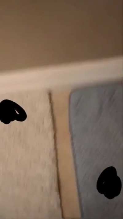 *PROLASPSED BOOTY HOLE*