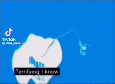 Idiots