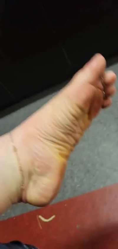 shoes coming off at work