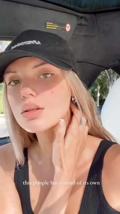 Instagram Story