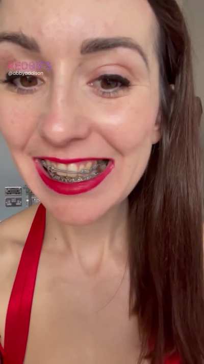 I love my braces because I have unusual bracket which I’ve not yet seen on another girl 