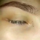 Cursed eye