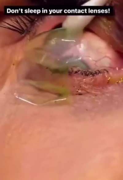 To safely wear contacts 