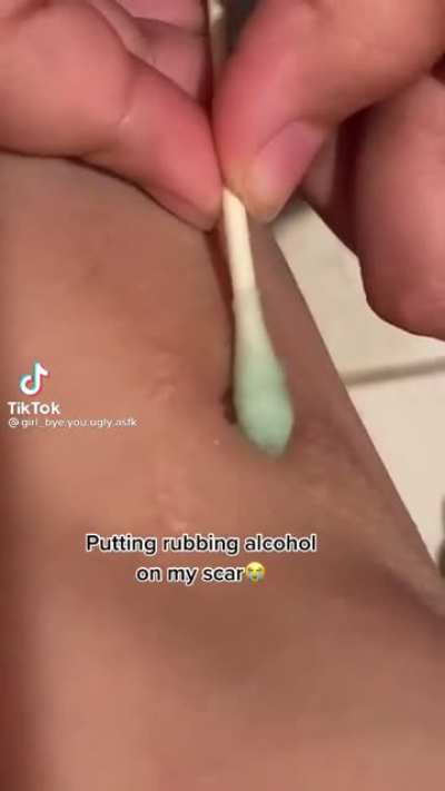 Should heal any second now