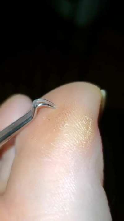 hair splinters suck