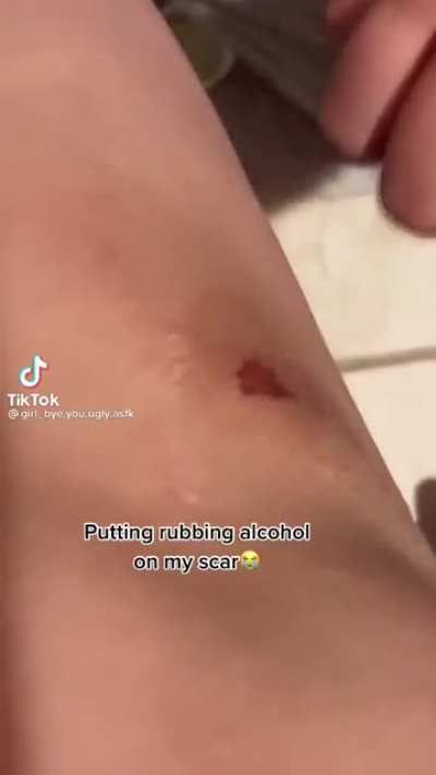 It doesn’t hur-....AHHHHHH