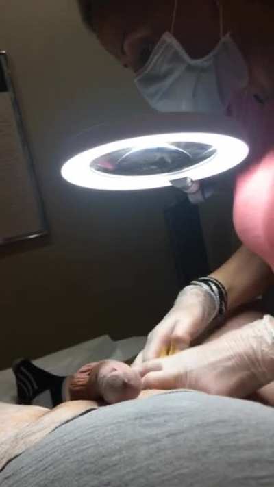 Male sugaring