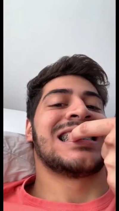 As a braces user, can confirm this video is true