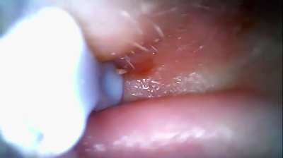 Ear pop round 2 part 3