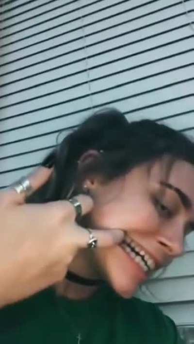 Girl got some of those venom genes