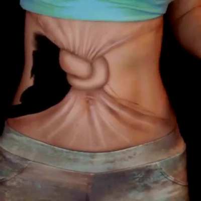 TIH tummy knots