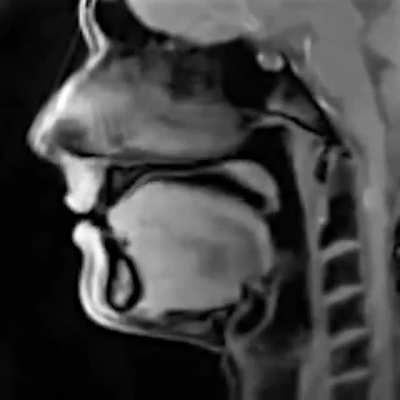 Real-time MRI scan of a person talking. Credit: Jens Frahm / MPIBPC