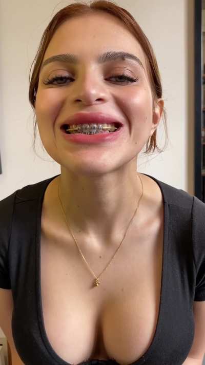 My braces control