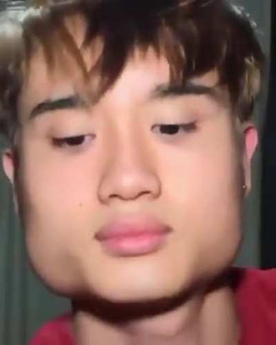 best plastic surgery 🥶