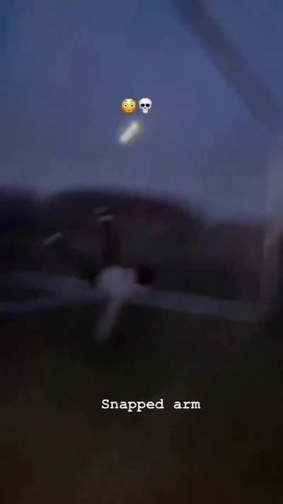 Young lad breaks his arm