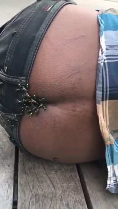 Hm