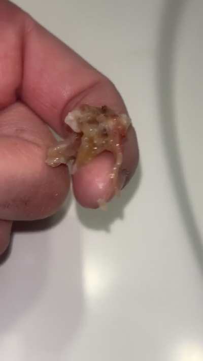 I swear these slimy ones be the hardest to get out