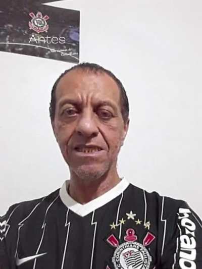 Carlinhos antes e depois
