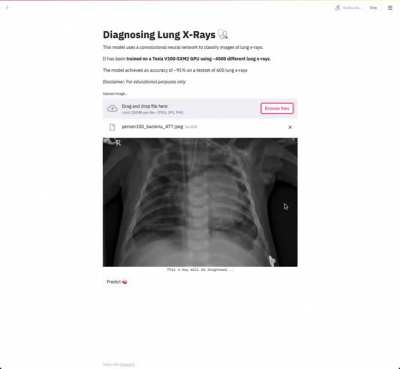 I wanted to try streamlit, so I trained a model to diagnose lung X-Rays (Pneumonia) and visualised it with streamlit [not hosted]