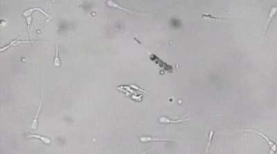 A nanobot picks up a lazy sperm by the fail and inseminates an egg with it