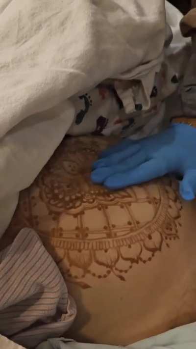 After Birth Uterus