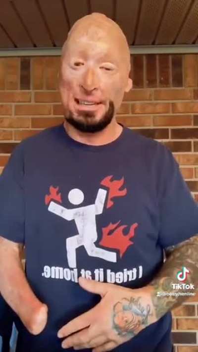 “Hey Smoothskin, Never Seen A Ghoul Before?” In all seriousness this guy even with his disability seems to have a great sense of humor. Hope he’s doing well.