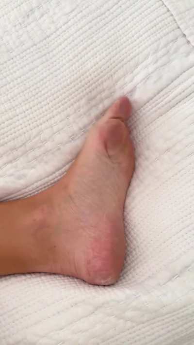 Wiggly Feet 