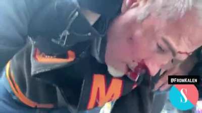 Antifa suckerpunches MAGA supporter