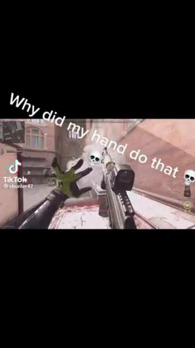 Anyone know why his hand do that