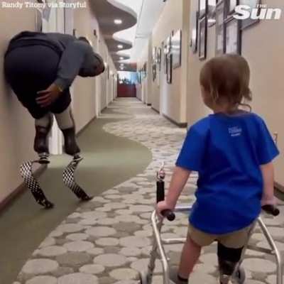 Double amputee cheers on toddler's first walk with prosthetic leg.