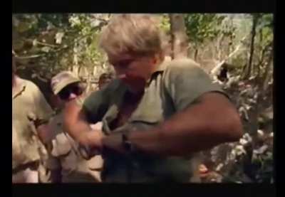 Steve Irwin “fixing” his broken finger.