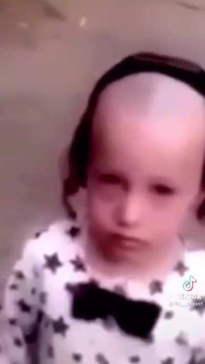 bros got the bald