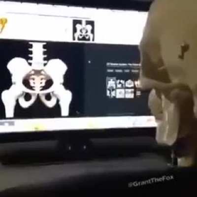 Osbir çeken iskelet deep web#1