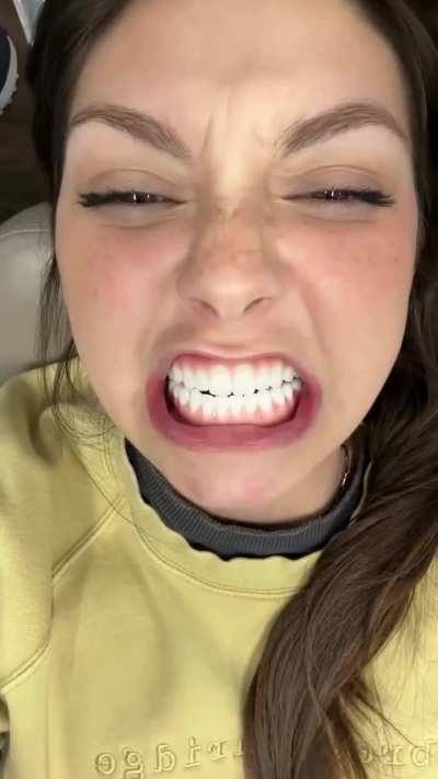 She gets a full set of dental implants