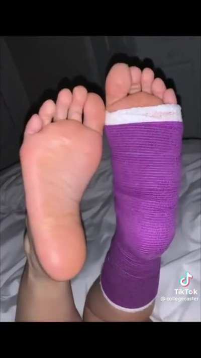collegecaster - Gorgeous soles!! I think I may have unlocked a new kink “Cast Fetish” hahaha