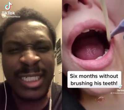 i hate that it's on beat 👀🦷