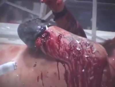 NSFL cut during wrestling match.